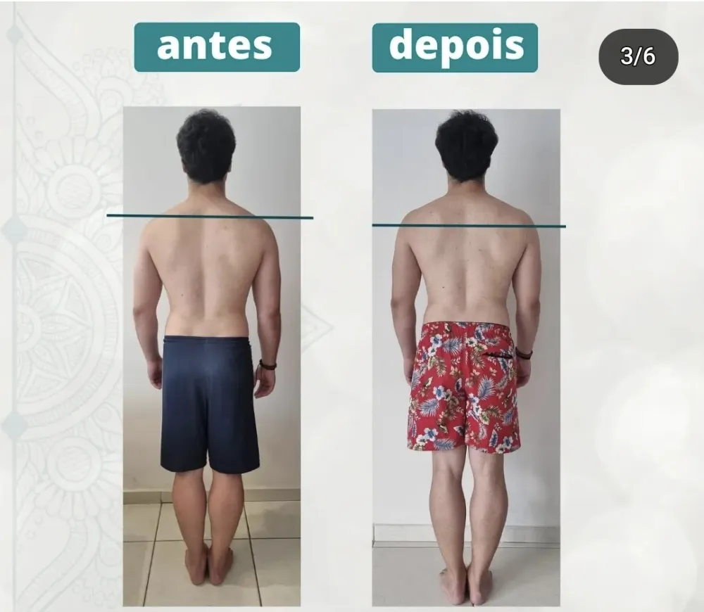 Resultado de tratamento na Benevento Fisioterapia